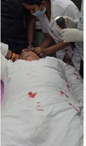 महाराष्ट्र के पूर्व गृह मंत्री अनिल देशमुख की कार पर हमला, लहूलुहान हुए 