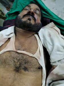 जेब में मोबाइल फटने से मौत